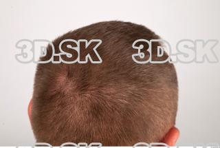 Hair texture of Gene 0004